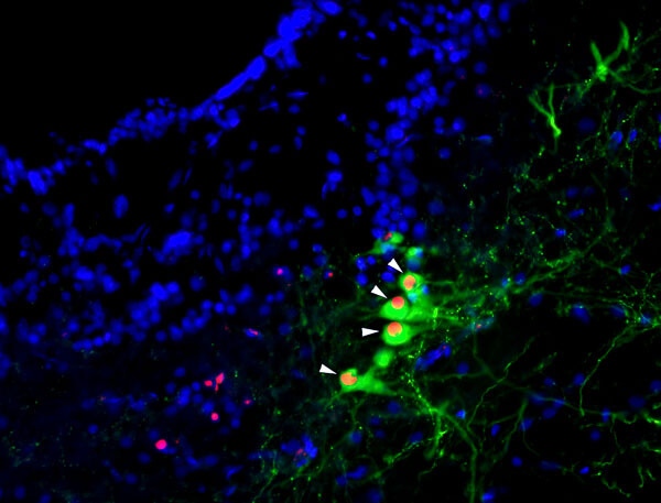Active neurons (green with red center) after exposure to the midshipman mating call.